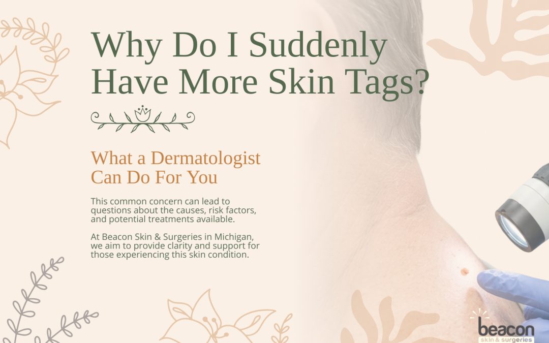 Why Do I Suddenly Have More Skin Tags?