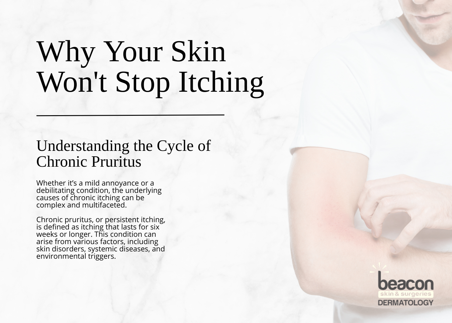 Wont-Stop-Itching